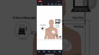 NONINVASIVE HEMODYNAMIC MONITORING [upl. by Seagrave]