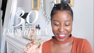 I Tried a DIY Apple Cider Vinegar Toner for 30 Days itsLakishaa [upl. by Adnohsat879]