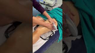 Experimenting with Tecar Therapy  tecartherapy [upl. by Eissirc]