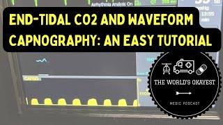 EndTidal CO2 and Waveform Capnography An Easy Tutorial Explicit [upl. by Treborsemaj]