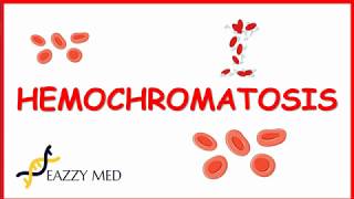 Hemochromatosis causespathophysiologysigns and symptomsdiagnosis and treatment [upl. by Easton332]