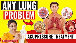 Any Lung Problem Treatment By Acupressure Points  Dr Richa Varshney [upl. by Arola]