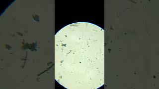 Que son los paramecios bueno aquí te explico ciencia microscope [upl. by Isidora621]