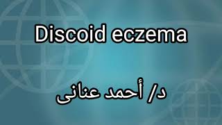 7 Discoid eczema by Dr Ahmed Anany [upl. by Nikki]