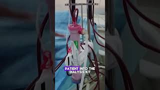 How Hemodialysis Filters Blood  Quick Overviewhemodialysis kidneydialysis dialysistreatment [upl. by Akere]