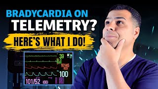 Inside the Hospital How I Handle Bradycardia and Telemetry Pauses [upl. by Nomsed]