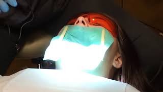 Dental Drilling for Root Canal Filling on Woman [upl. by Allyn]