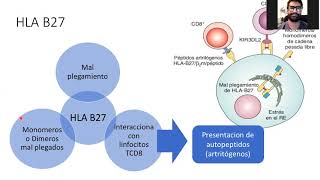 Fisiopatología de la espondiloartritis Dra Nayeli Ortega [upl. by Earesed]