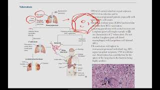 Mycobacteria Tuberculosis Leprosy  Microbiology  14  First Aid USMLE in UrduHindi [upl. by Bena]