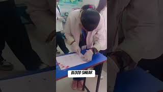 Blood smear preparation youtube shorts dream subscribe ytshorts [upl. by Nylemaj]