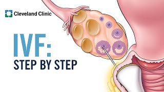 How Does In Vitro Fertilization IVF Work A StepbyStep Explanation [upl. by Berny588]