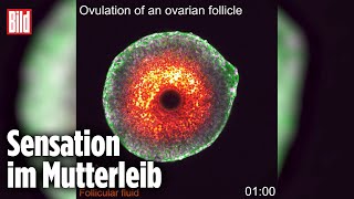 Forscher filmen erstmals Eisprung [upl. by Netti460]