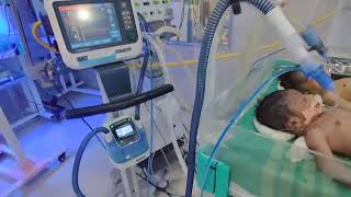 Newborn baby on ventilator in NICU  Neonatal ICU  SNCU  Special Newborn Care Unit [upl. by Hakaber384]