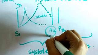 Murmur of aortic stenosis explained [upl. by Chesna]