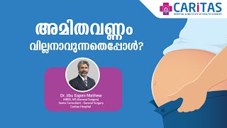 അമിതവണ്ണം വില്ലനാവുന്നതെപ്പോൾ  Obesity Care  Caritas Hospital Kottayam [upl. by Willetta]