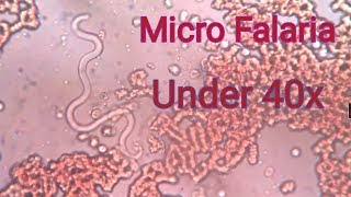 Falaria under 40x microscope [upl. by Hareemas741]