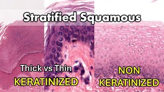 Keratinized vs Non Keratinized Thick vs Thin [upl. by Frager]