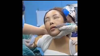 Facelifting 😱 beauty facelift transformation shwechuukoreaskincareandcosmetics [upl. by Schwarz]