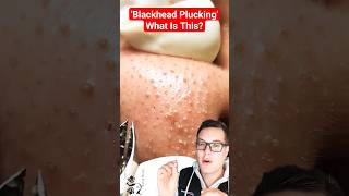 PLUCKING BLACKHEADS  New Blackhead Removal Technique shorts [upl. by Enaid100]