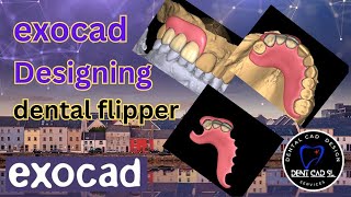 ExoCad dental flipper design [upl. by Florencia]