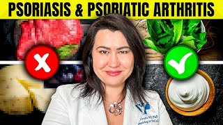 8 WORST Foods for Psoriasis And Psoriatic Arthritis [upl. by Olocin]