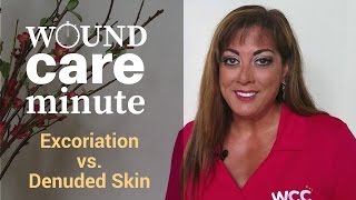 Whats the Difference Between Excoriation and Denuded Skin [upl. by Nisbet659]