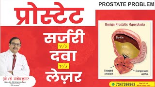 The untold truth about prostate surgery Prostate Surgery LASER Medicine [upl. by Naldo886]