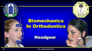 Use of headgear in Orthodontics [upl. by Enaywd]