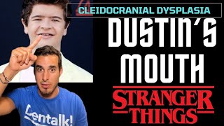 STRANGER THINGS  The rare disease that affects Dustin’s teeth  Cleidocranial Dysplasia [upl. by Margie344]