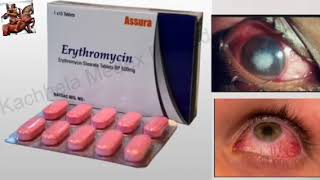 Antibiotic tablet ।। Erythromycin ।। Eye infection ।। Optometry Solution [upl. by Verina]