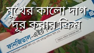 ত্বকে Fungidal HC cream এর কাজ কি  ব্রণ সহ ত্বকের যে কোন সমস্যায় ক্রিম টি ব্যবহার করার নিয়ম [upl. by Dasha]