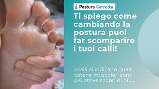 Calli dolorosi Sai che puoi farli scomparire lavorando sulla postura [upl. by Etireugram]