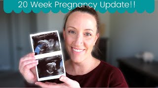 20 Week Pregnancy Update  Anatomy Scan and Trisomy 13 Update [upl. by Renick865]