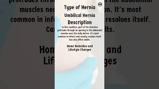 Umbilical Hernia Home Remedies [upl. by Saile126]