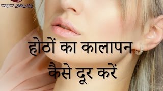 होठों का कालापन कैसे दूर करें  Hothon ka Kalapan Kaise Dur kare  How to get pink lips faster [upl. by Anidam]