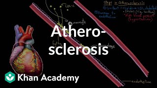 Atherosclerosis  Circulatory System and Disease  NCLEXRN  Khan Academy [upl. by Brunhilda]