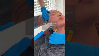 Get Glowing With Potenza RF Microneedling [upl. by Ravid]