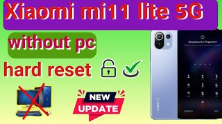 Mi 11 lite password reset without PC [upl. by Aileen]