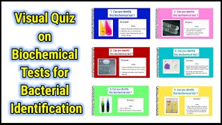 Visual Quiz on Biochemical tests for identification of bacteria  basicappliedmicrobiology [upl. by Satsoc558]