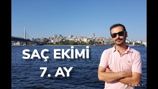 SAÇ EKİMİ 7 AY [upl. by Mochun]