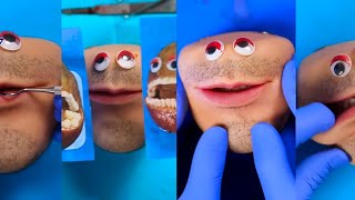 Fruit Surgery with Mr Kiwi Original Mr Kiwi Episodes Discount Dentist  TikTok  Fleeting Films [upl. by Airec]