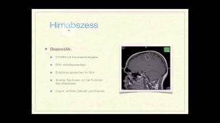 Basiskurs Neurologie Entzündliche Erkrankungen Teil 814 [upl. by Leanne]