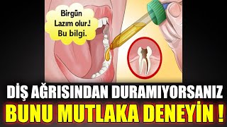 Diş Ağrısından Duramıyorsanız 1 Damlası Anında Ağrıyı Keser [upl. by Senhauser]