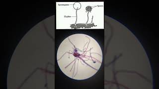 Rhizopus slide under MicroscopeMicroorganism [upl. by Patrice]