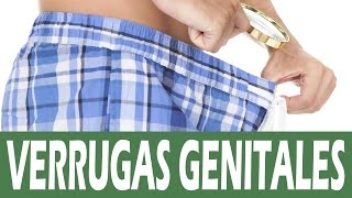 Cómo quitar verrugas genitales – Remedios caseros para las verrugas genitales femeninas masculinas [upl. by Kristofor]