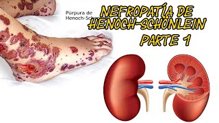 Glomerulopatías Nefropatía de HenochSchönlein  Parte 1  Previo al Fail [upl. by Ahtikal]