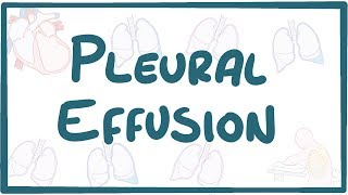 Pleural Effusion  causes symptoms diagnosis treatment pathology [upl. by Azil157]