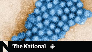 Cases of stomachbug causing norovirus on the rise in Canada [upl. by Oironoh288]