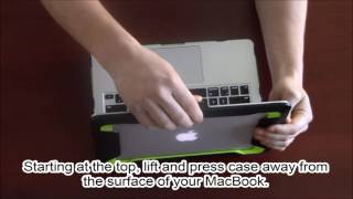 Macbook Armorbox Installation Video  IBlason [upl. by Arded]