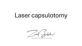 Laser capsulotomy [upl. by Ybok]